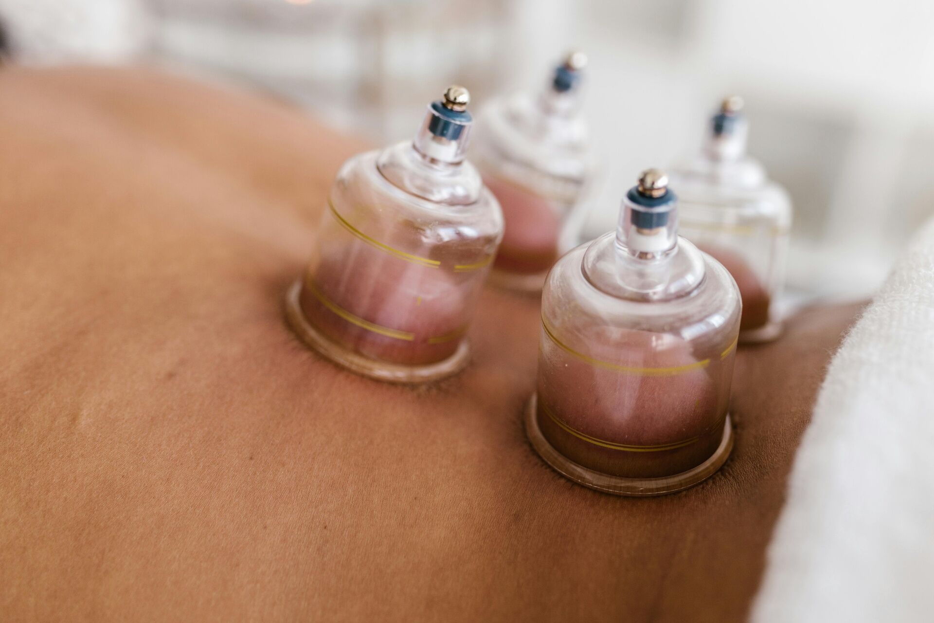 Cupping massage Breda